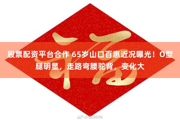 股票配资平台合作 65岁山口百惠近况曝光！O型腿明显，走路弯腰驼背，变化大